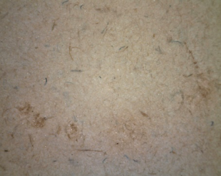 A part of the drawing with black spots removed.